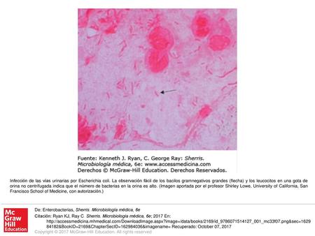 Infección de las vías urinarias por Escherichia coli