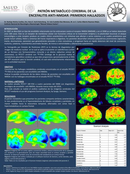 PATRÓN METABÓLICO CEREBRAL DE LA ENCEFALITIS ANTI-NMDAR: PRIMEROS HALLAZGOS INICIAL Dr. Rodrigo Muñoz Casillas, Dra. Nora E. Kerik Rotenberg, Dr. Iván.