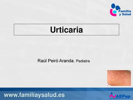 Urticaria  Raúl Peiró Aranda. Pediatra
