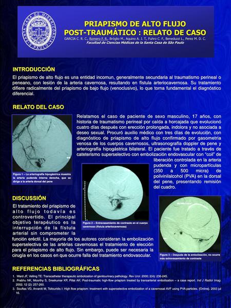 PRIAPISMO DE ALTO FLUJO POST-TRAUMÁTICO : RELATO DE CASO GARCIA C. R. C., Romero F. R., Bróglio M., Aquino A. J. T., Fuhro C. F., Beneduzzi L., Perez.