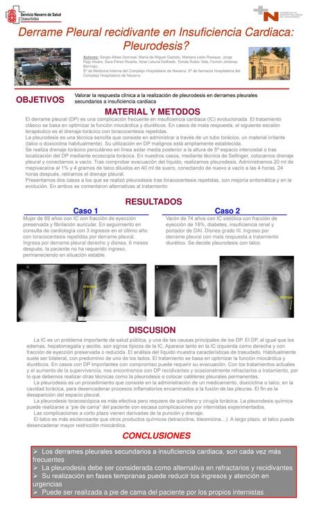 Derrame Pleural recidivante en Insuficiencia Cardiaca: