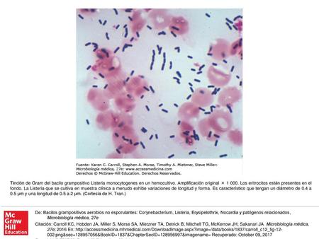 Tinción de Gram del bacilo grampositivo Listeria monocytogenes en un hemocultivo. Amplificación original × 1 000. Los eritrocitos están presentes en el.