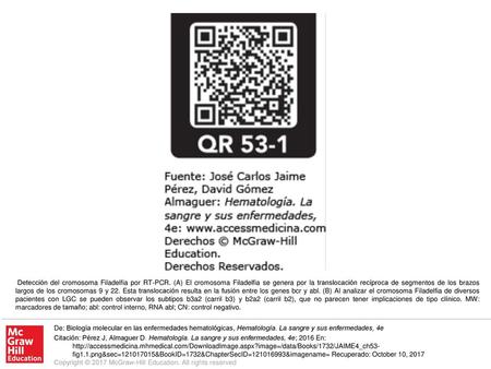 Detección del cromosoma Filadelfia por RT-PCR