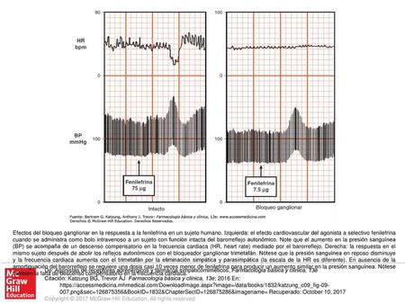 Efectos del bloqueo ganglionar en la respuesta a la fenilefrina en un sujeto humano. Izquierda: el efecto cardiovascular del agonista a selectivo fenilefrina.
