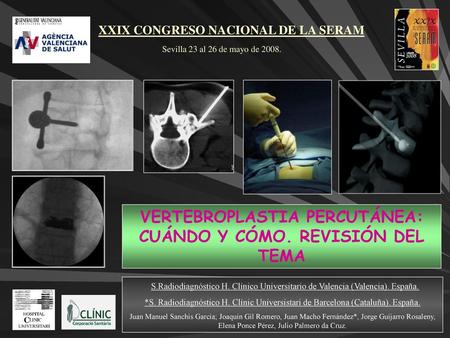 VERTEBROPLASTIA PERCUTÁNEA: CUÁNDO Y CÓMO. REVISIÓN DEL TEMA