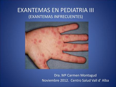 EXANTEMAS EN PEDIATRIA III (EXANTEMAS INFRECUENTES)