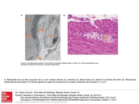 A. Micrografía de una fibra muscular lisa (1) con cuerpos densos (2), caveolas (3), lámina basal (4); observe la terminal del axón (5). Microscopia electrónica.