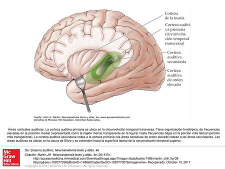 Áreas corticales auditivas