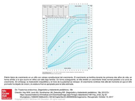 Patrón típico de crecimiento en un niño con retraso constitucional del crecimiento. El crecimiento se lentifica durante los primeros dos años de vida,