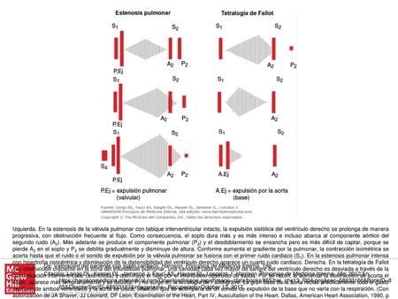 Izquierda. En la estenosis de la válvula pulmonar con tabique interventricular intacto, la expulsión sistólica del ventrículo derecho se prolonga de manera.