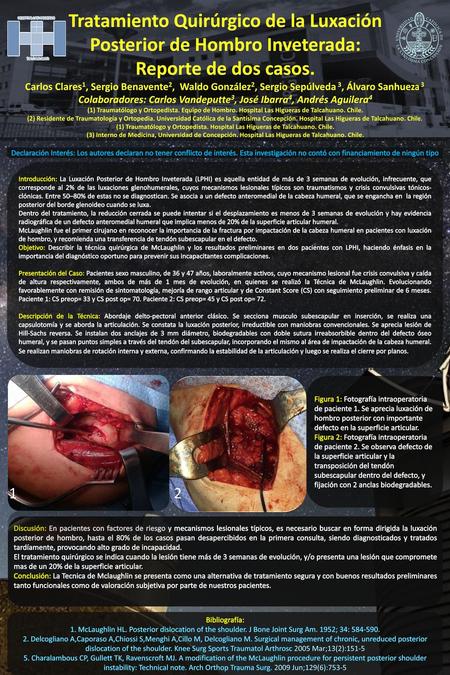 Tratamiento Quirúrgico de la Luxación Posterior de Hombro Inveterada: