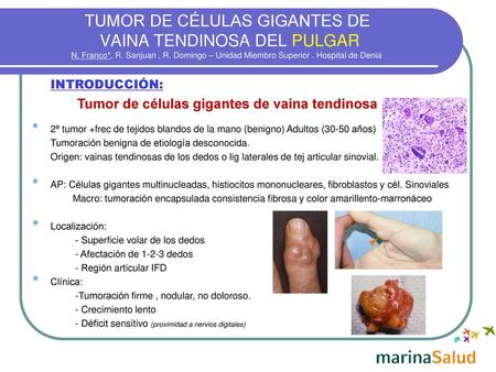 Tumor de células gigantes de vaina tendinosa