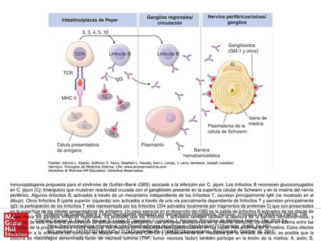 Inmunopatogenia propuesta para el síndrome de Guillain-Barré (GBS) asociado a la infección por C. jejuni. Los linfocitos B reconocen glucoconjugados en.