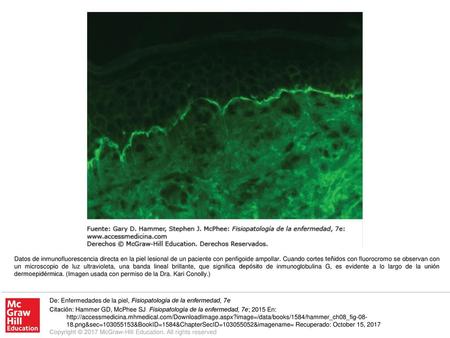 Datos de inmunofluorescencia directa en la piel lesional de un paciente con penfigoide ampollar. Cuando cortes teñidos con fluorocromo se observan con.