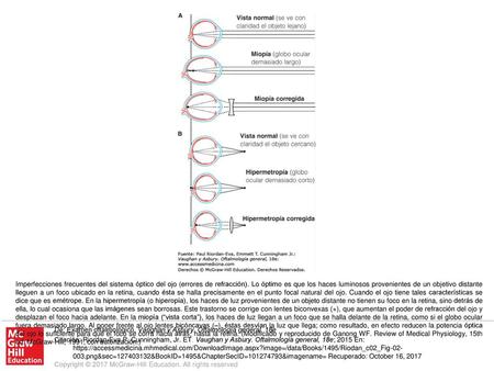 Imperfecciones frecuentes del sistema óptico del ojo (errores de refracción). Lo óptimo es que los haces luminosos provenientes de un objetivo distante.