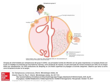 Sinopsis de enfermedades por estreptococos del grupo A (GAS)