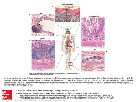 Fotomicrografías de tejido linfoide asociado a mucosas. A