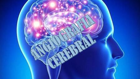 ANGIOGRAFIA CEREBRAL.