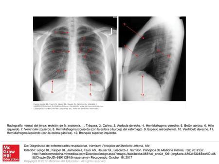 Radiografía normal del tórax: revisión de la anatomía. 1. Tráquea. 2