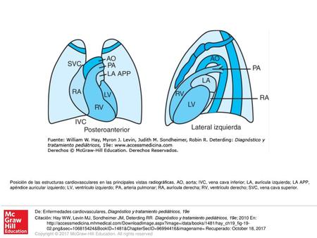 Posición de las estructuras cardiovasculares en las principales vistas radiográficas. AO, aorta; IVC, vena cava inferior; LA, aurícula izquierda; LA APP,