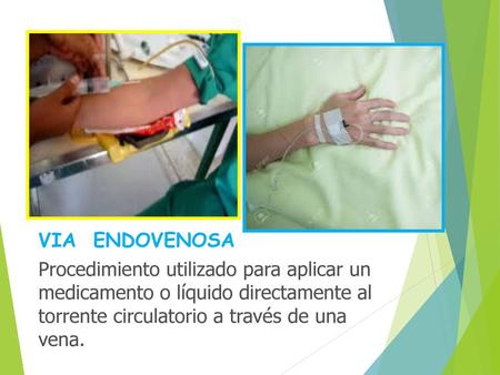 VIA ENDOVENOSA Procedimiento utilizado para aplicar un medicamento o líquido directamente al torrente circulatorio a través de una vena.