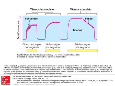 Tétanos incompleto y completo