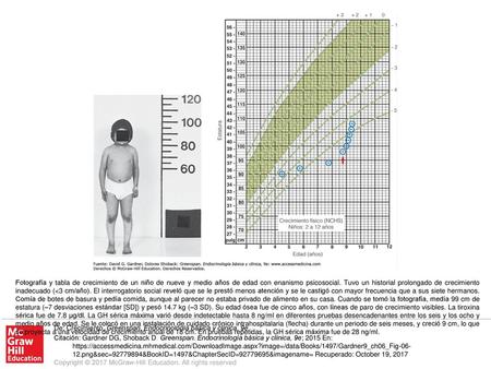 Fotografía y tabla de crecimiento de un niño de nueve y medio años de edad con enanismo psicosocial. Tuvo un historial prolongado de crecimiento inadecuado.