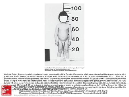 Varón de 2 años 5 meses de edad con pubertad precoz verdadera idiopática. Para los 10 meses de edad, presentaba vello púbico y agrandamiento fálico y testicular.