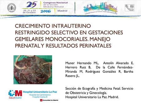 CRECIMIENTO INTRAUTERINO RESTRINGIDO SELECTIVO EN GESTACIONES GEMELARES MONOCORIALES. MANEJO PRENATAL Y RESULTADOS PERINATALES Muner Hernando ML, Antolín.