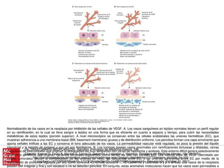 Normalización de los vasos en la neoplasia por inhibición de las señales de VEGF. A. Los vasos sanguíneos en tejidos normales tienen un perfil regular.