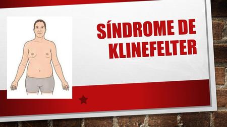 Síndrome de KlinefeLteR