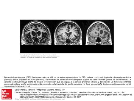 Demencia frontotemporal (FTD)