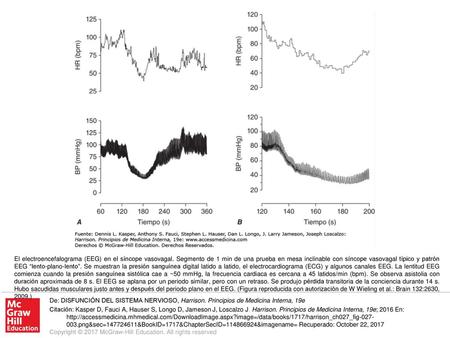 El electroencefalograma (EEG) en el síncope vasovagal