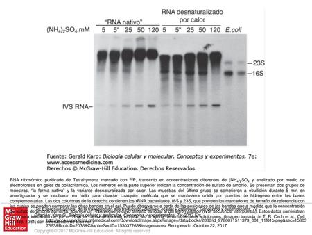 RNA ribosómico purificado de Tetrahymena marcado con 32P, transcrito en concentraciones diferentes de (NH4)2SO4 y analizado por medio de electroforesis.