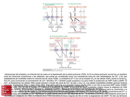 Interacciones del endotelio y el músculo liso de vasos en la hipertensión de la arteria pulmonar (PAH). A) En la arteria pulmonar normal hay un equilibrio.