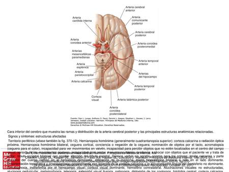 Territorio central. Síndrome talámico: pérdida de sensibilidad (todas las modalidades), dolor y disestesias espontáneos, coreoatetosis, temblor intencional,