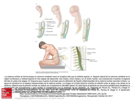 La cisterna lumbar se forma porque la columna vertebral crece en longitud más que la médula espinal. A. Aspecto lateral de la columna vertebral en la región.