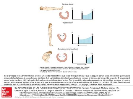 En el prolapso de la válvula mitral se produce un sonido mesosistólico que no es de expulsión (C) y que es seguido por un soplo telesistólico que muestra.