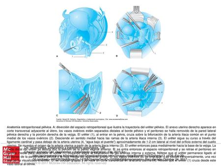 Anatomía retroperitoneal pélvica