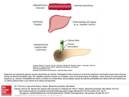 Diagrama que representa algunas causas importantes de ictericia