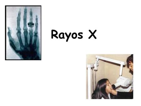 Rayos X.