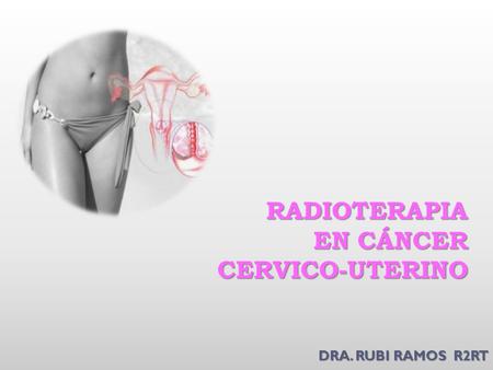 RADIOTERAPIA EN CÁNCER CERVICO-UTERINO