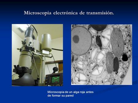 Microscopia electrónica de transmisión. Microscopia de un alga roja antes de formar su pared.