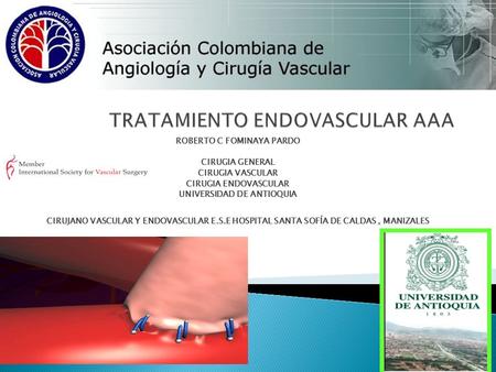 ROBERTO C FOMINAYA PARDO CIRUGIA GENERAL CIRUGIA VASCULAR CIRUGIA ENDOVASCULAR UNIVERSIDAD DE ANTIOQUIA CIRUJANO VASCULAR Y ENDOVASCULAR E.S.E HOSPITAL.