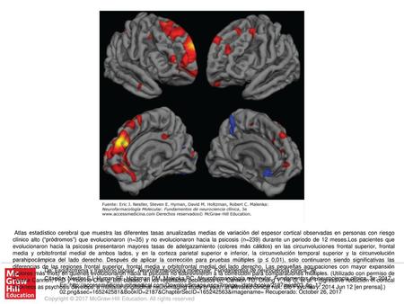 Atlas estadístico cerebral que muestra las diferentes tasas anualizadas medias de variación del espesor cortical observadas en personas con riesgo clínico.