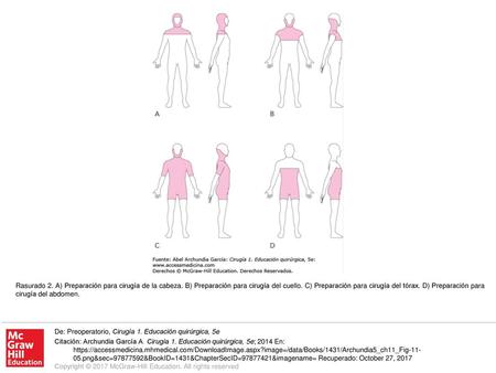 Rasurado 2. A) Preparación para cirugía de la cabeza