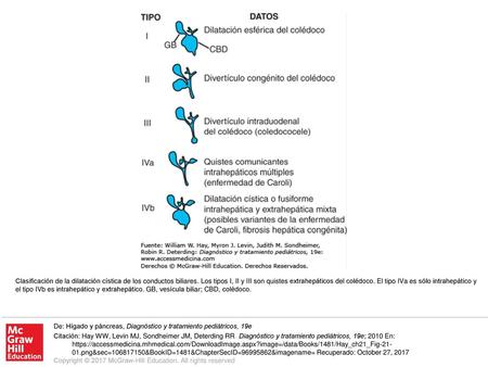 Clasificación de la dilatación cística de los conductos biliares