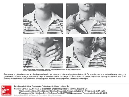 Examen de la glándula tiroides. A