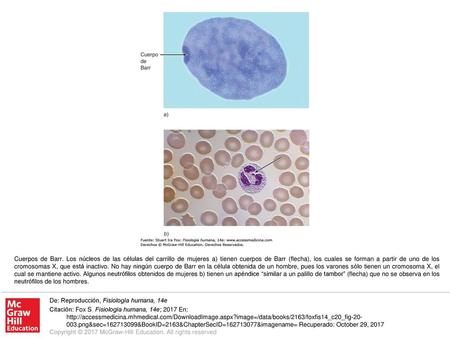Cuerpos de Barr. Los núcleos de las células del carrillo de mujeres a) tienen cuerpos de Barr (flecha), los cuales se forman a partir de uno de los cromosomas.