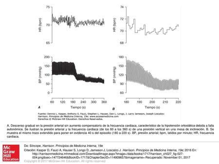 A. Descenso gradual en la presión arterial sin aumento compensatorio de la frecuencia cardiaca, característico de la hipotensión ortostática debida a falla.